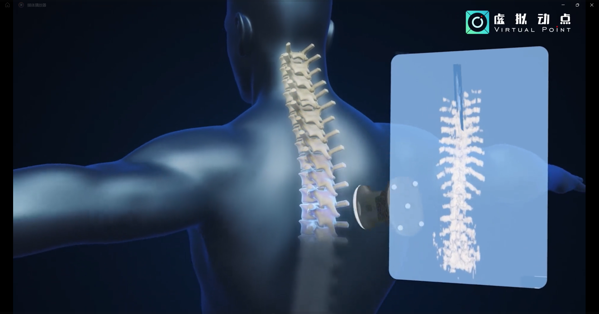 888电子·虚拟动点OptiTrack开创3D超声成像在脊柱诊断中的应用